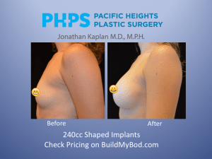A decrease in breast augmentation? Not good for Victoria's Secret!, Plastic Surgeon San Francisco